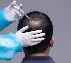 Best Hair Loss Treatments for Men - Hair & Skin Science